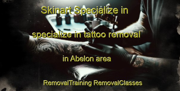 Skinart Specialize in specialize in tattoo removal in Abelon area | #RemovalTraining #RemovalClasses #SkinartTraining-Spain