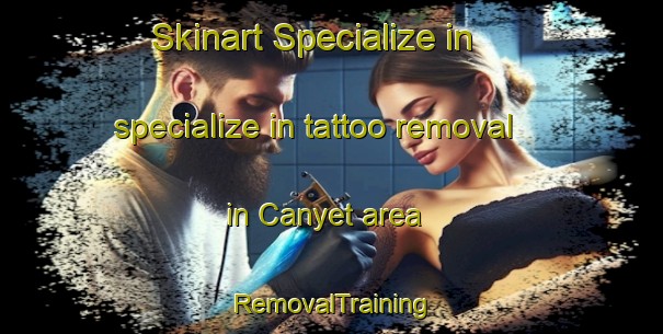 Skinart Specialize in specialize in tattoo removal in Canyet area | RemovalTraining | RemovalClasses | SkinartTraining-Spain