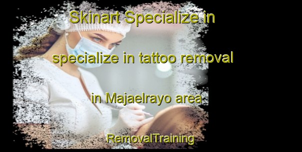 Skinart Specialize in specialize in tattoo removal in Majaelrayo area | RemovalTraining | RemovalClasses | SkinartTraining-Spain